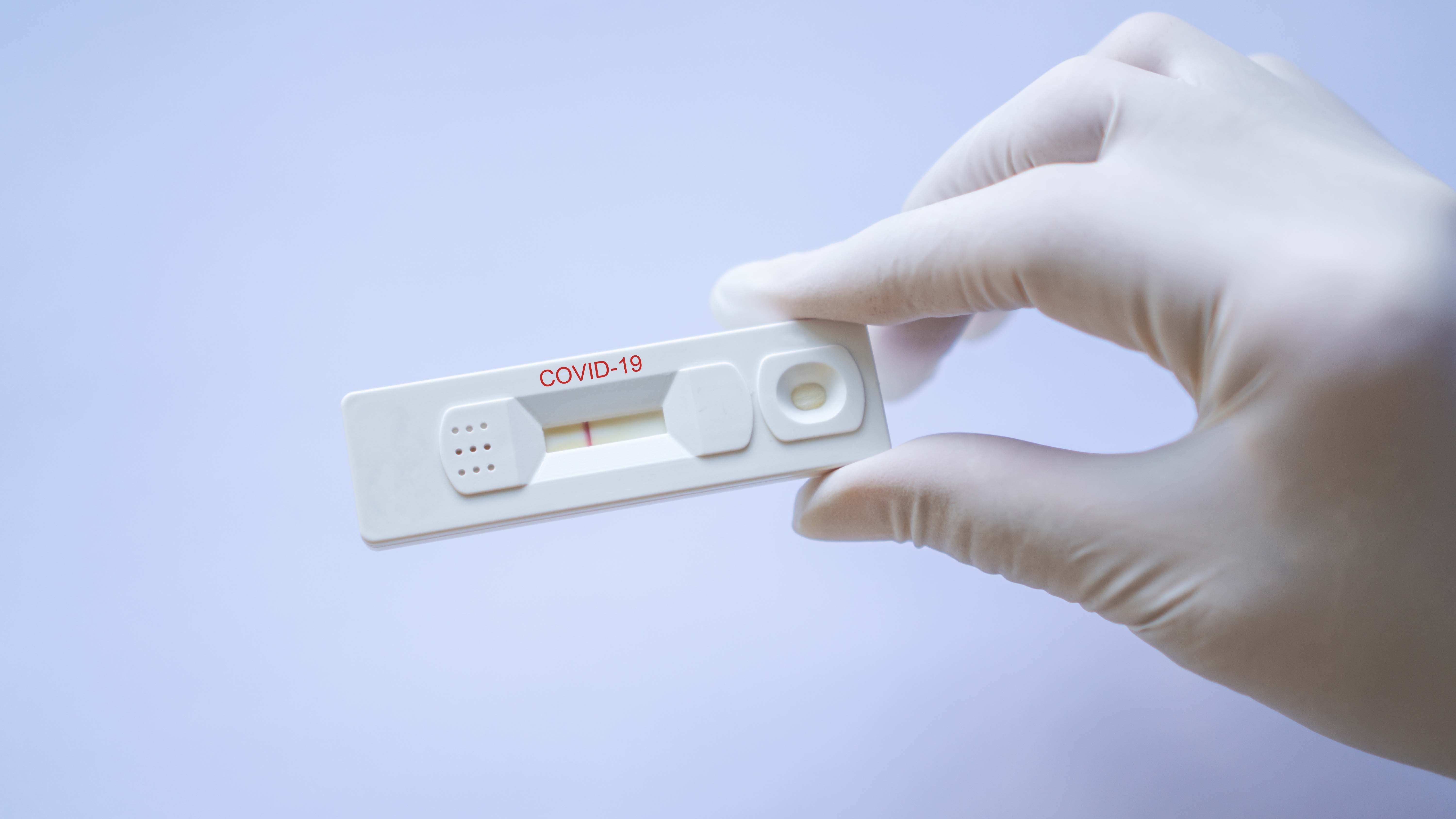 Negative test result by using rapid test device for COVID-19, no Negative test result by using rapid test device for COVID-19, no